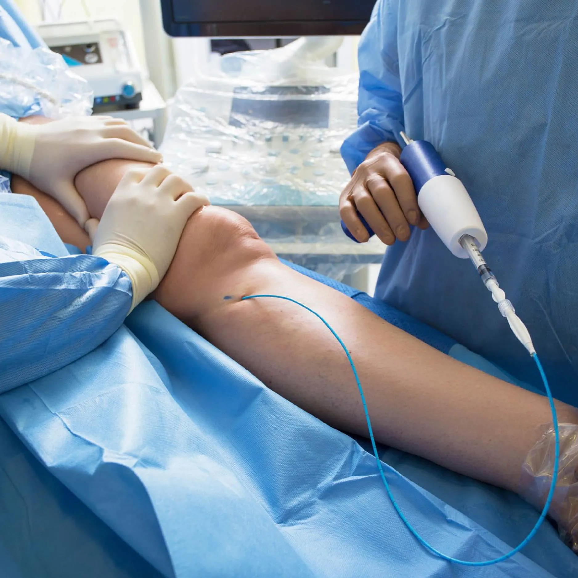 Cirurgia Endovascular